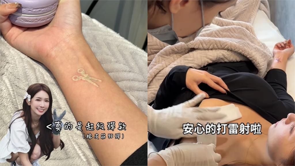 啦啦隊女神「強忍50倍痛」做這事！認了「工作受影響」：想要身上乾淨些