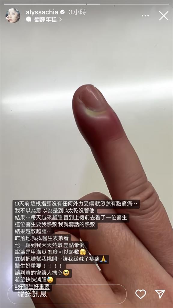 賈靜雯在美國驚傳意外!被誤診「這裡化膿」她崩潰大喊5字