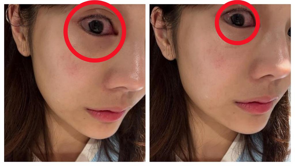 啦啦隊女神琳妲凌晨突發病痛!急衝醫院卻碰壁…曬照曝光真相嚇壞粉絲