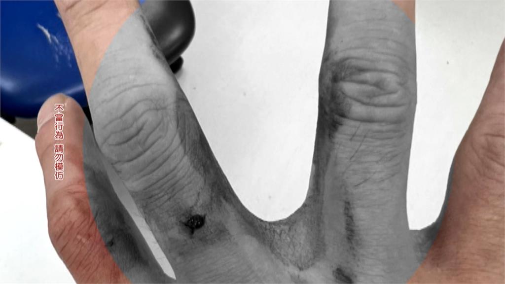 北市醉漢折警車天線！　遭制止怒攻2警　1警腦震盪