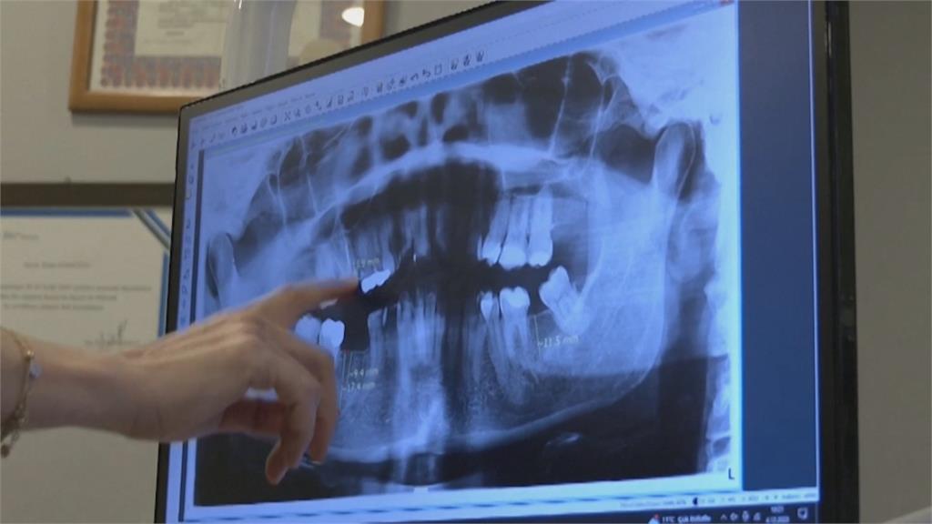 英國國健局資金短缺！用健保看牙恐要等1年半　民眾飛去土耳其看牙醫成趨勢