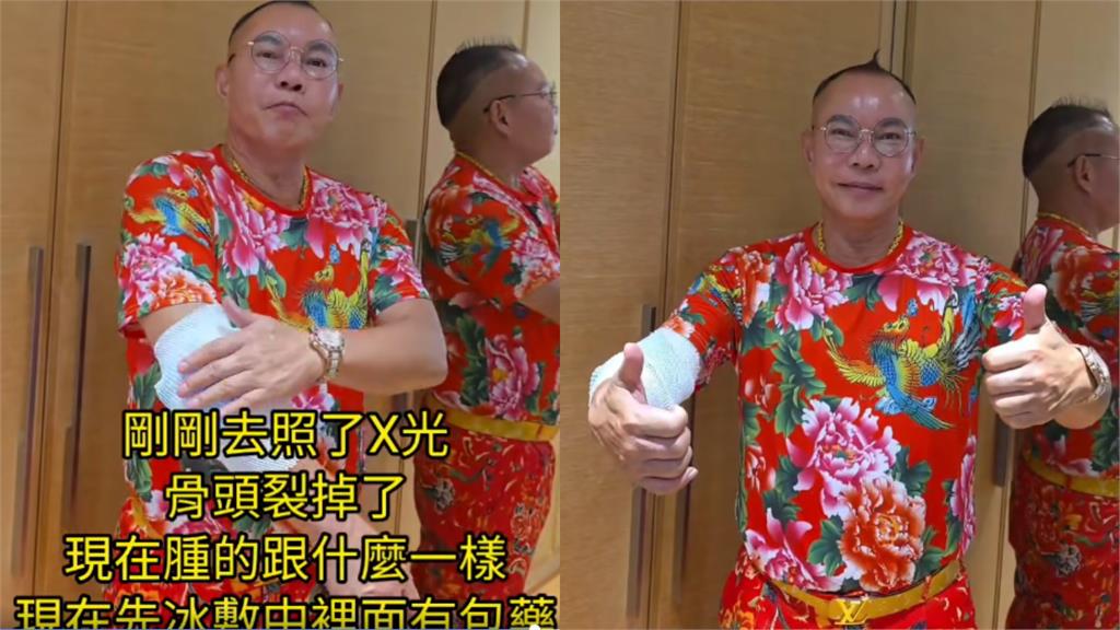 昔錄綜藝「跳繩慘跌3次」休養半年！吊車大王激情嗨玩竟「摔椅下骨裂」