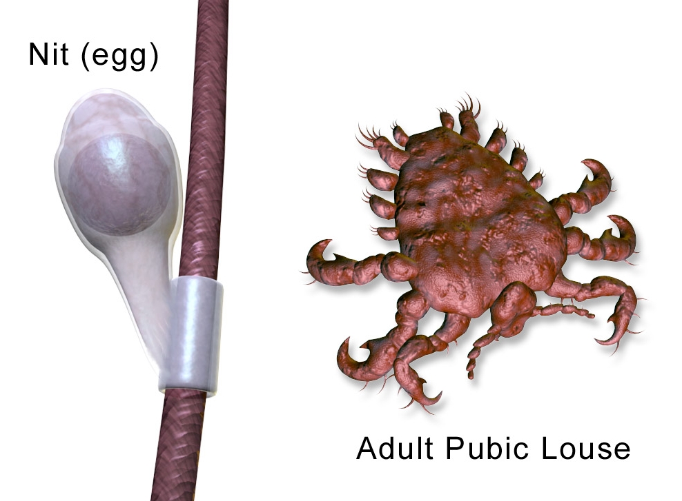 阿北下面奇癢「找妹妹被勸看醫生」！褲子一脫⋯醫看呆：滿布白透蟲卵