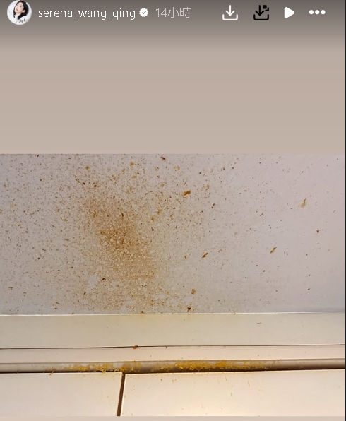 8點檔林志玲「微波爐煮雞蛋」爆炸!眼角膜破洞、皮膚燙傷「送醫慘況曝」