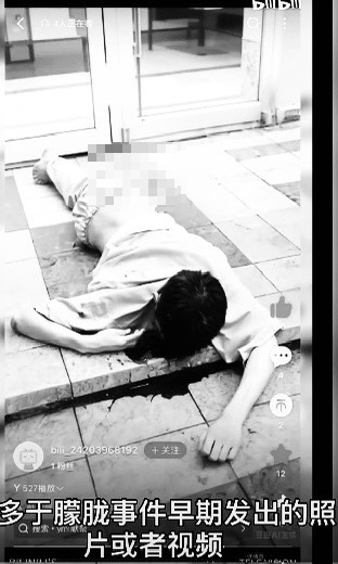 爆驗出多人體液…于朦朧「虐殺影像」暗網流出!付費解鎖「酷刑片」屍檢反轉真相曝