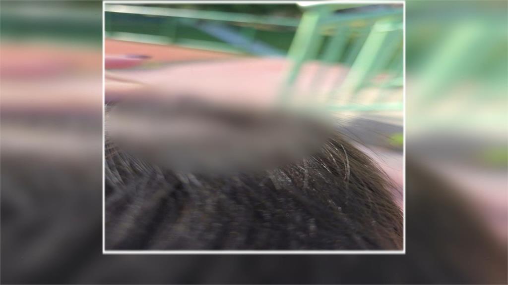 健體設施藏危機！　林口足夢公園「大轉輪」掉落砸男童頭部