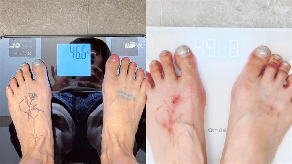 32歲泫雅減肥暴瘦「剩49公斤」!往下看「腳背全是傷」驚悚照片曝光了