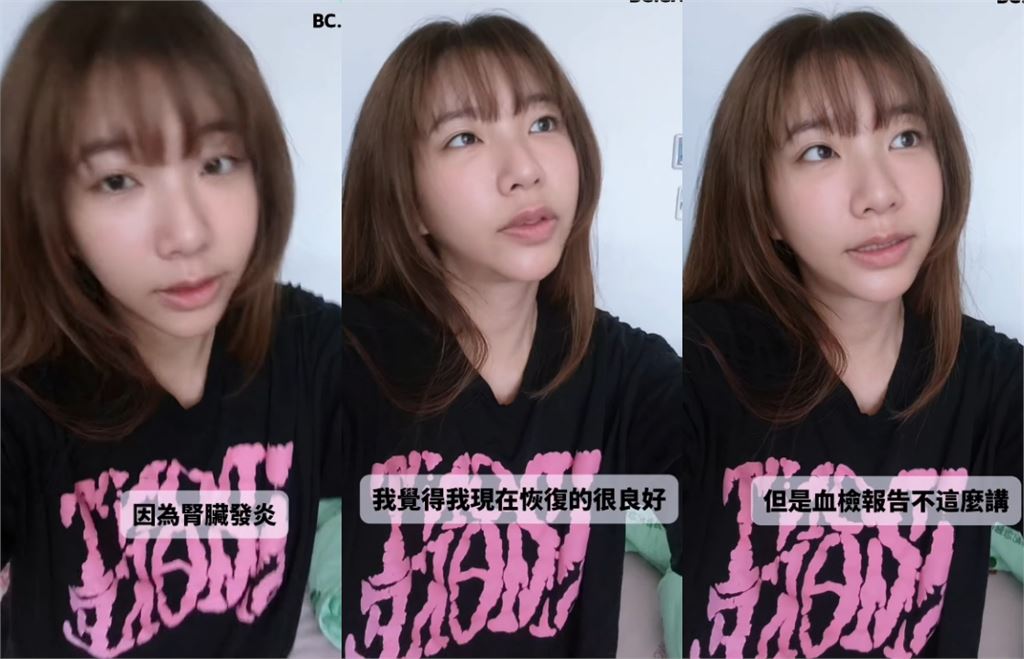 台灣第一女優突掛急診！緊急住院「腎臟出事」素顏揭病況：血檢報告不這麼講…