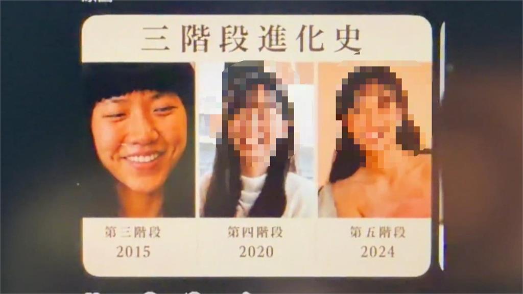 網路瘋傳許姓護理師長相進化史　照片本尊澄清「不是我！」
