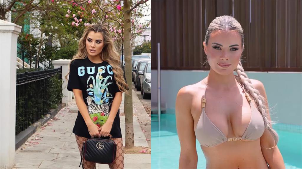 辣模做整形手術「雙眼被矇住」看不見!醫院男員工竟趁機「掀衣扒光」意圖侵犯