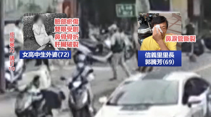 恐怖！跟騷女高中生還毆人　72歲外婆「肝臟破裂」