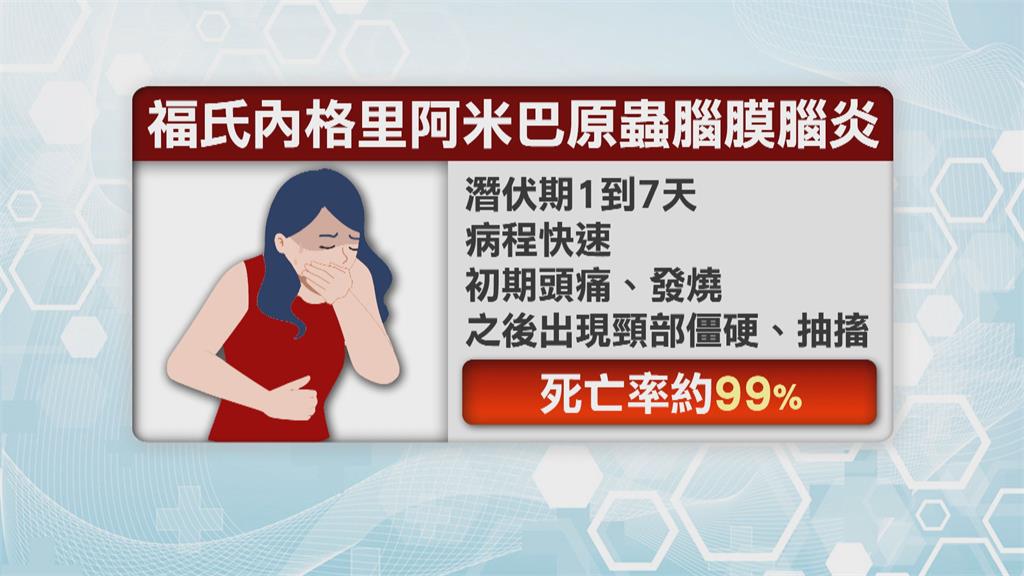 疑玩水感染阿米巴腦膜腦炎　30多歲女發病一週死亡