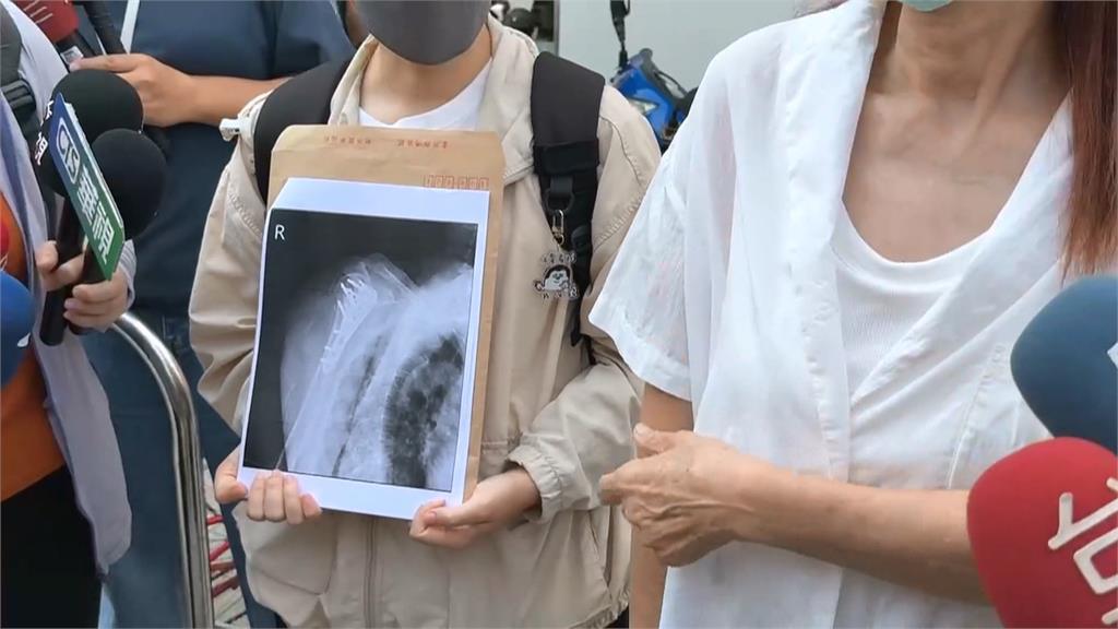高雄清潔隊清溝防護不足　67歲婦跌水溝骨折