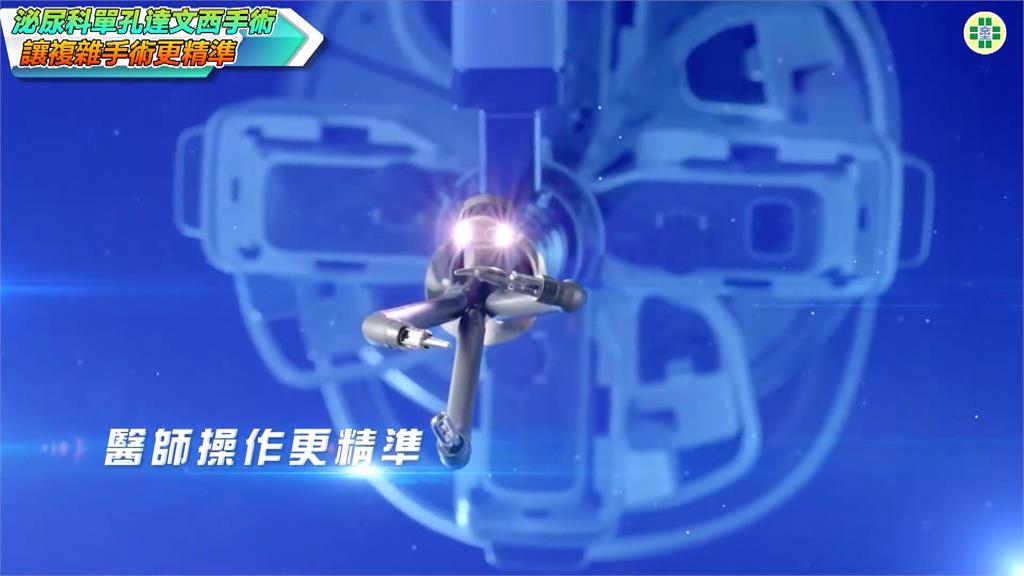 達文西手術破6千例 童綜合引進第二台達文西單孔機械臂