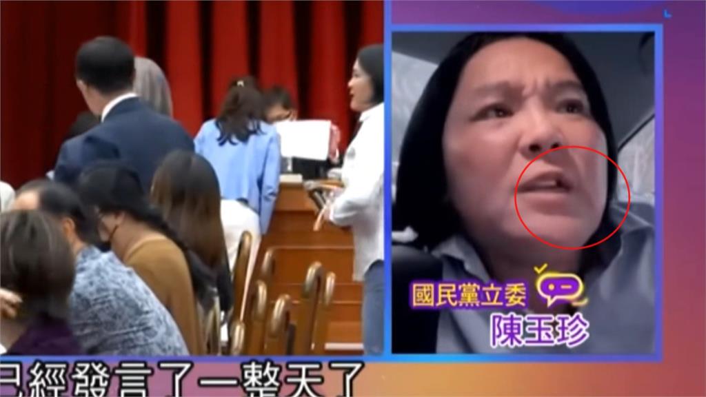 「夾手珍」重演? 陳玉珍控"牙齒被打斷" 綠委批:前天就缺角