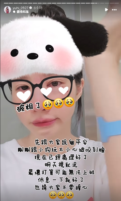 樂天女孩驚傳被狗咬傷 滲血畫面嚇壞粉絲 樂天女孩遭「愛犬咬破相」急送醫!「眼下血狂流」畫面曝光…她嘆:恐無法上班
