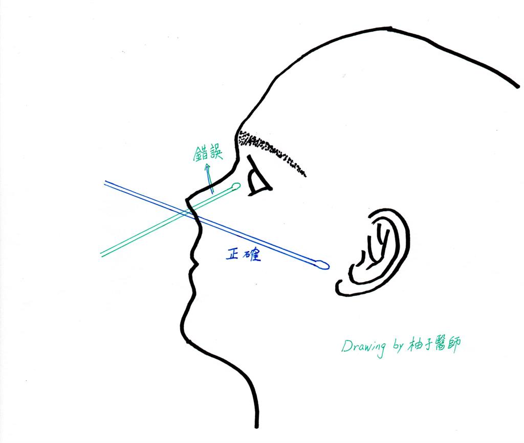 唾液vs鼻咽快篩怎麼選？優缺點「1次看懂」6QA教最準確驗法