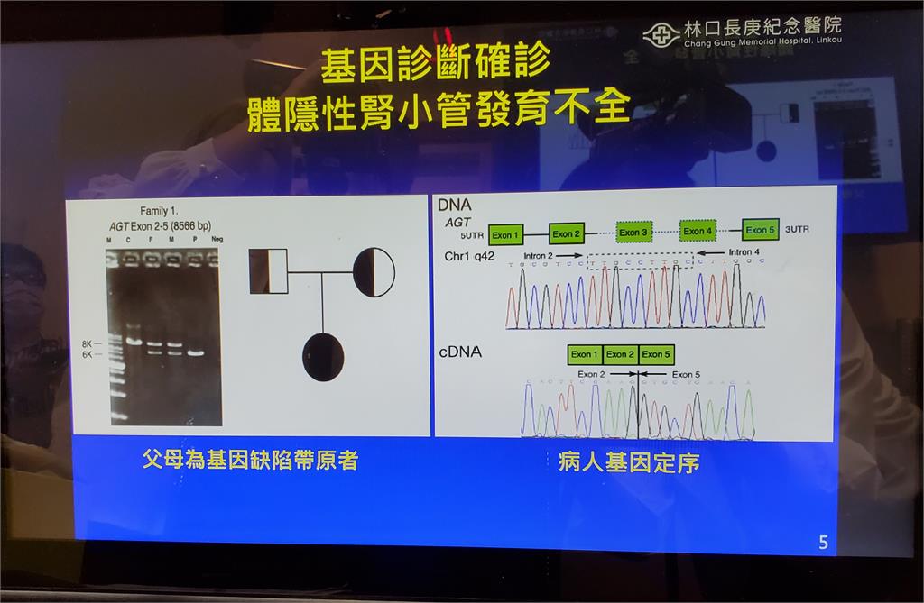 死亡率達9成！ 長庚發現台灣特有致命遺傳腎臟病　3類孕婦建議篩檢