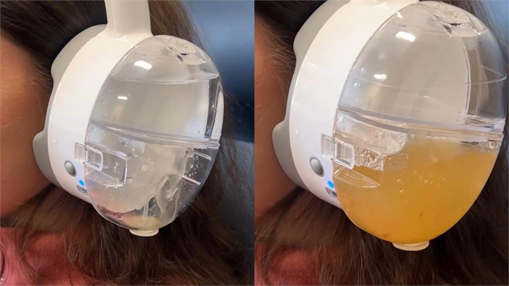 真空洗耳機吸出超濃濁「耳垢濃湯」!實測影片震撼逾3530萬人