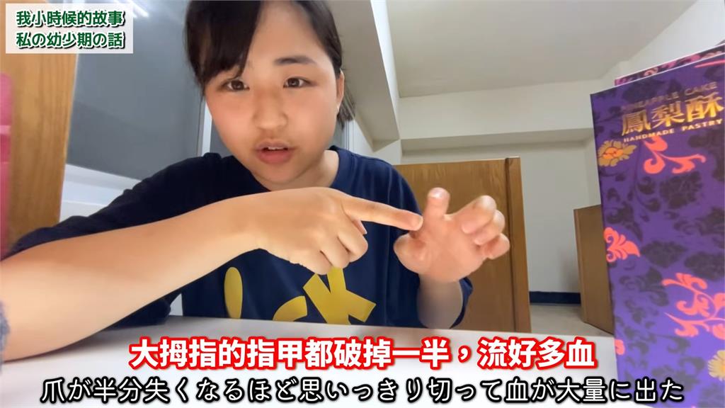 受傷也不呼救!混血妞來台4年「不敢依賴別人」 尬稱:覺得自己做錯事