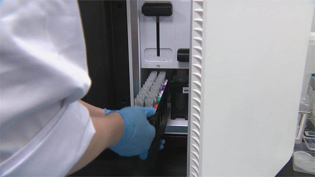 30歲身體60歲腎？ 別忽略腎臟警訊