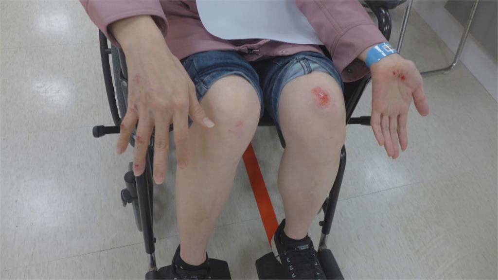 悚!公車門夾塑膠袋 婦慘遭拖行全身傷