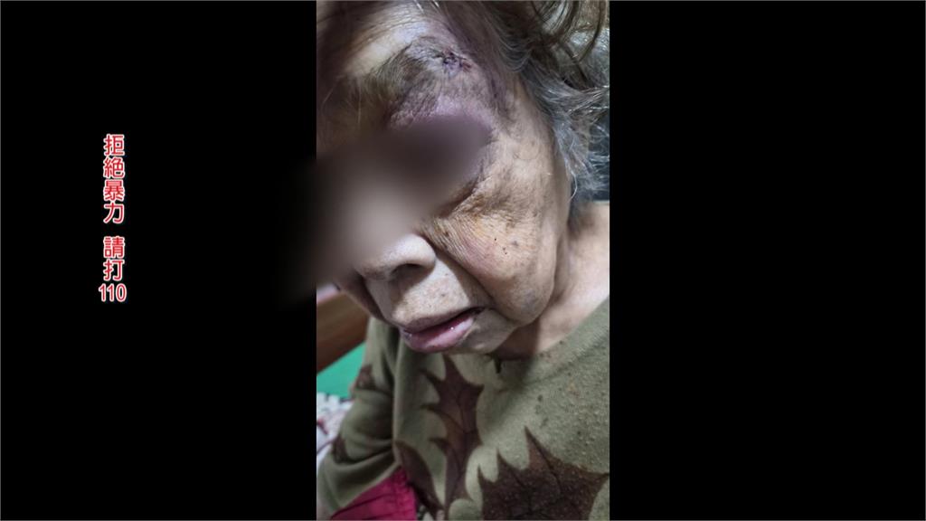 悚！印尼籍看護連3天毆打虐待93歲嬤　幾天後死亡家屬疑脫不了關係