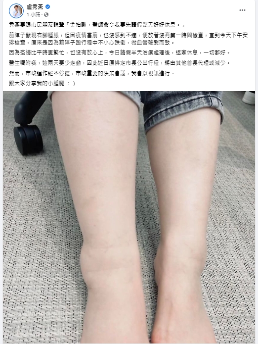 快新聞／盧秀燕跌傷變「小腫腿」　向市民拍謝：醫師命令我請假