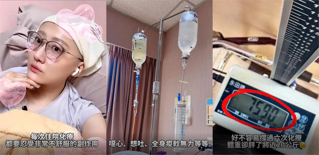 國光女神「消失半年剃光頭」爆肥20公斤！親認罹癌曝「57秒艱辛過程」網看哭