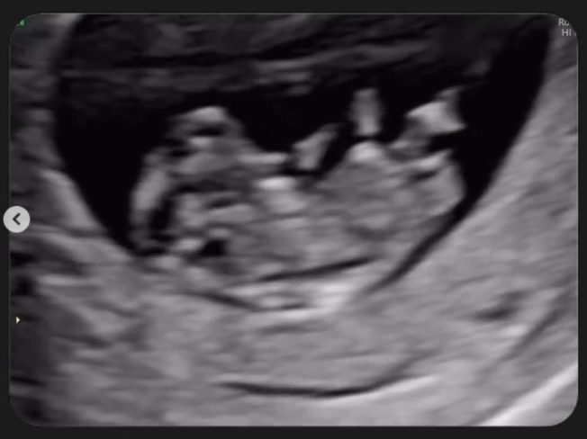 吳珊儒宣布懷孕5個月！吳宗憲「鬆口曝預產期」：公的母的都非常開心