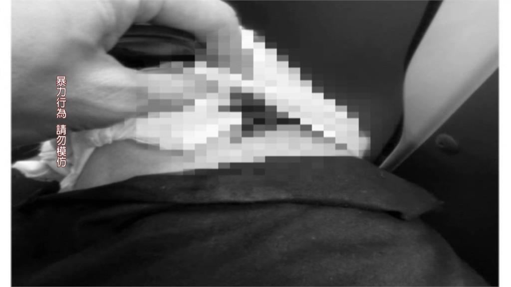 中信兄弟啦啦隊"汶汶"遭男粉持刀攻擊頸部　送往馬偕急救暫無生命危險