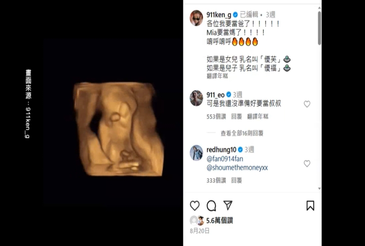 玖壹壹15週年拋雙重喜訊! 聽聞江蕙抗癌春風驚訝語無倫次