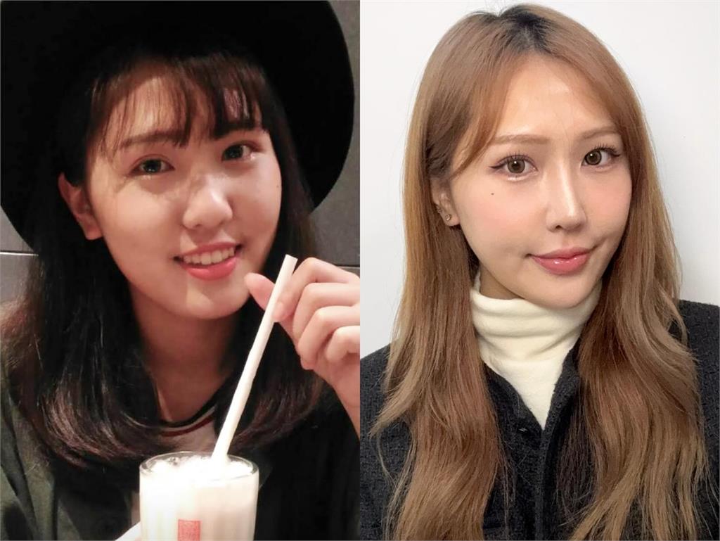 Joeman新女友網紅「整形前後對比照」流出…她直言:整個判若兩人!