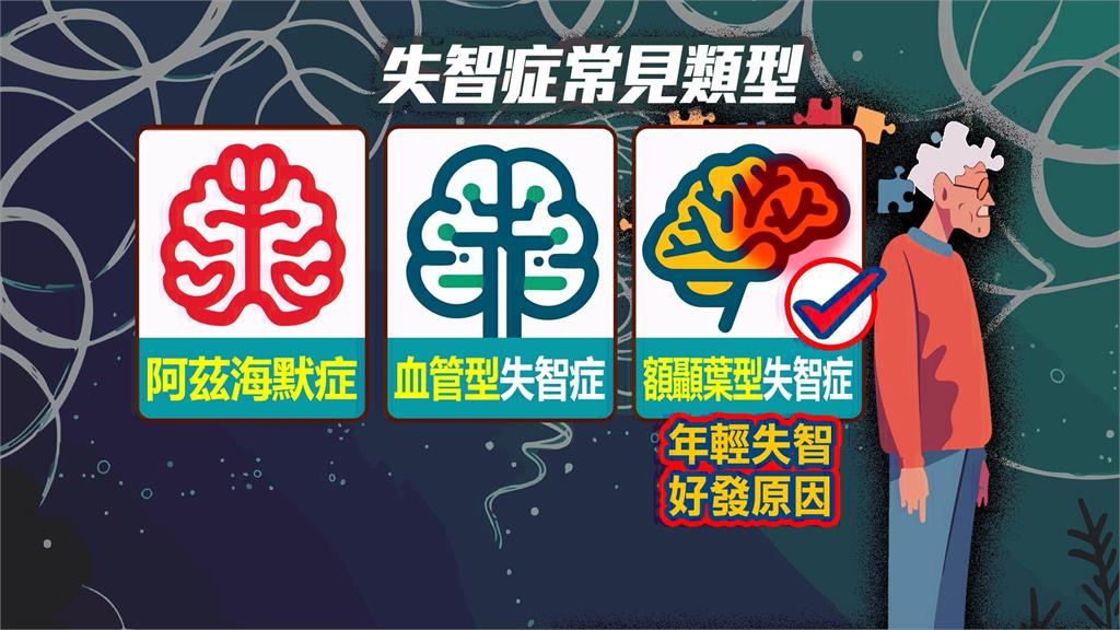異言堂／憂鬱、焦慮或情緒不穩? 當心年輕型失智找上門。
