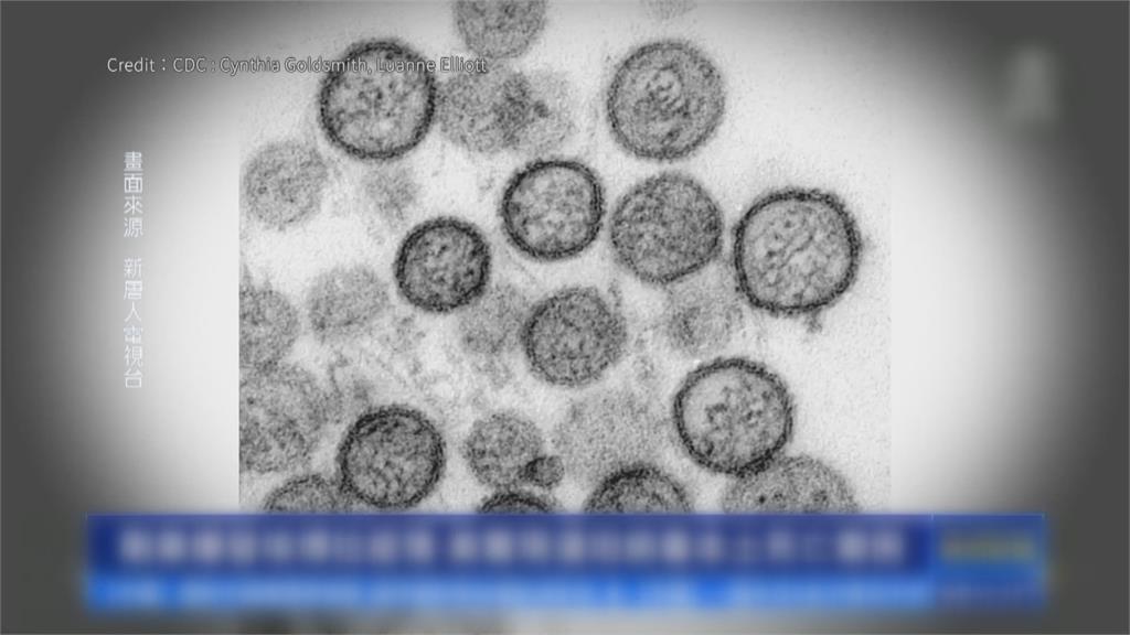 美爆「無名漢他病毒」死亡案例 衛生單位:與漢他病毒郵輪無關
