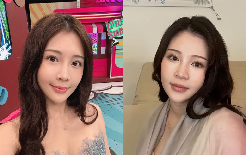 鄭家純產後12天「臉蛋變化太驚人」！親曬「震撼AB對比」網瞪大眼：好神奇…