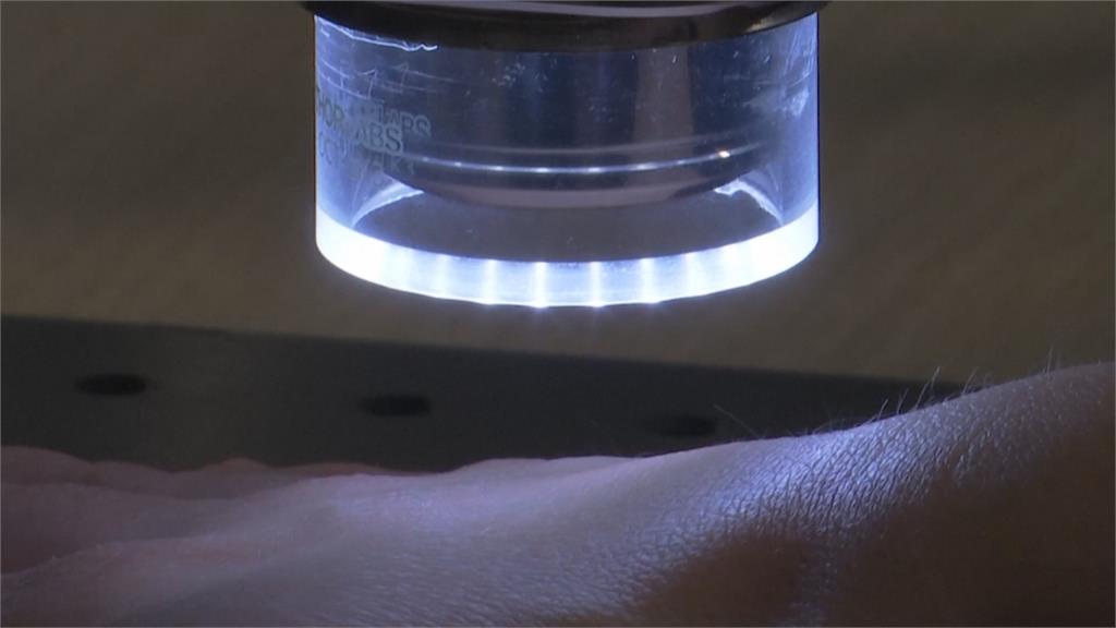 英國最新研發濕疹感測器　核心零件竟是兒童玩具蜂鳴器