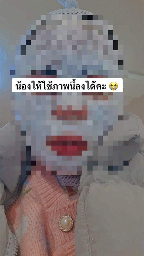 男子怕被戴綠帽趁妻熟睡「拿煮沸熱水倒臉」!老婆毀容PO網求救驚人傷勢曝