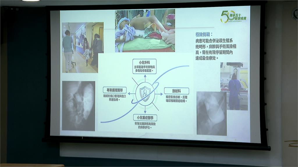 非洲7歲"無肛症女童"跨半個地球 北醫附醫助重獲新生