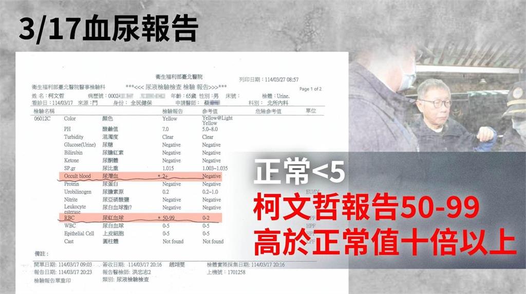 快新聞/柯文哲痛到受不了 陳佩琪哭了:結婚35年竟只能從媒體得知先生有腎結石