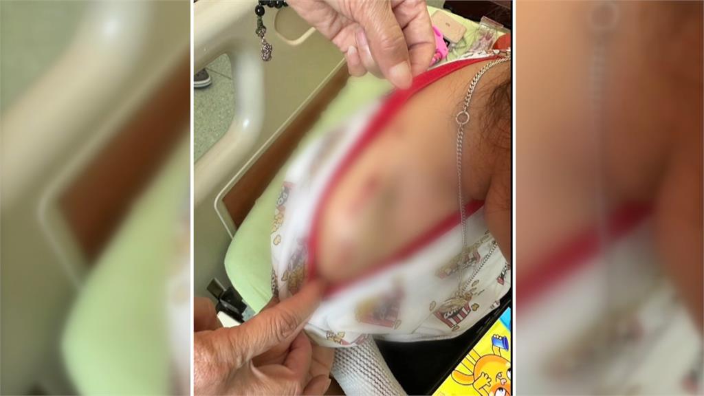 不受控！　母帶３女逛三義木雕街　店狗突竄出狂咬　２童全身傷送醫