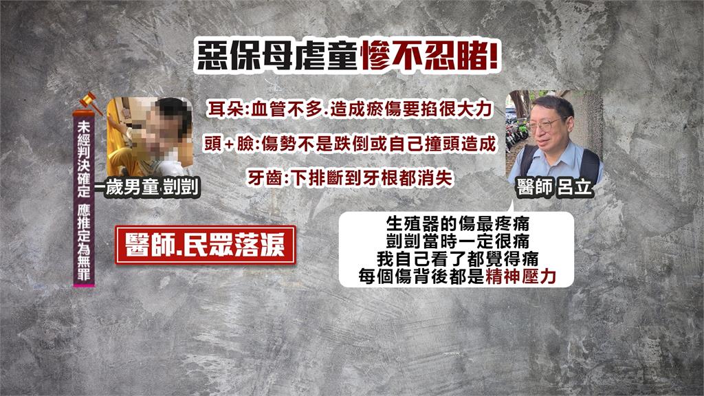 剴剴案傳關鍵鑑定人！　台大兒醫師呂立：自己看了都痛