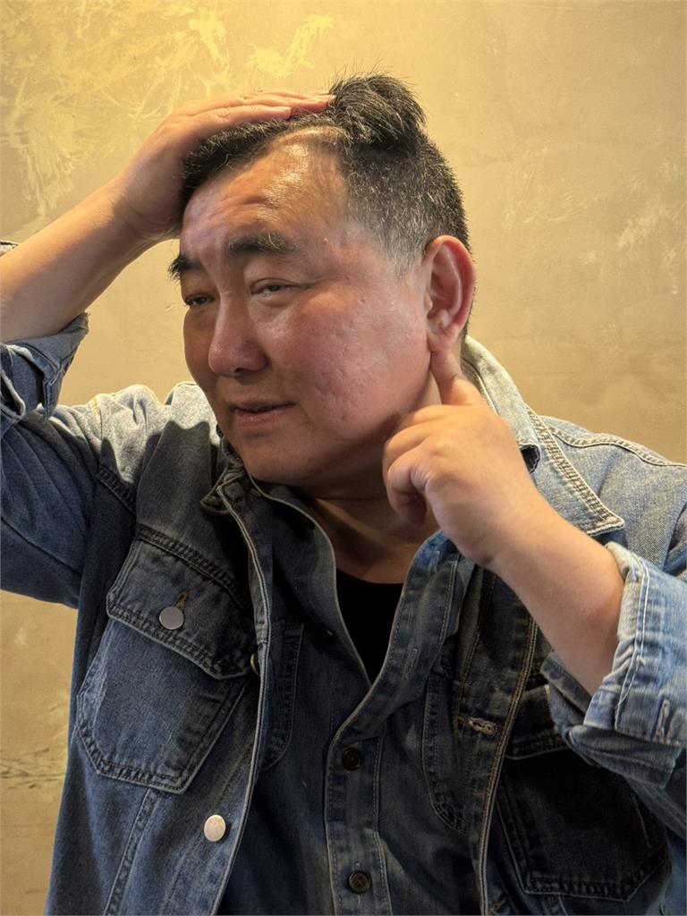 徐亨認離婚賣3房產獨扛債!消風20公斤「1關鍵」不動刀憂「面癱」!
