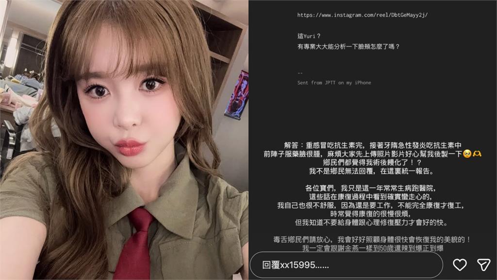 網友封「最正啦啦隊女神」遭質疑醫美過頭饅化！她坦言：確實蠻走心的