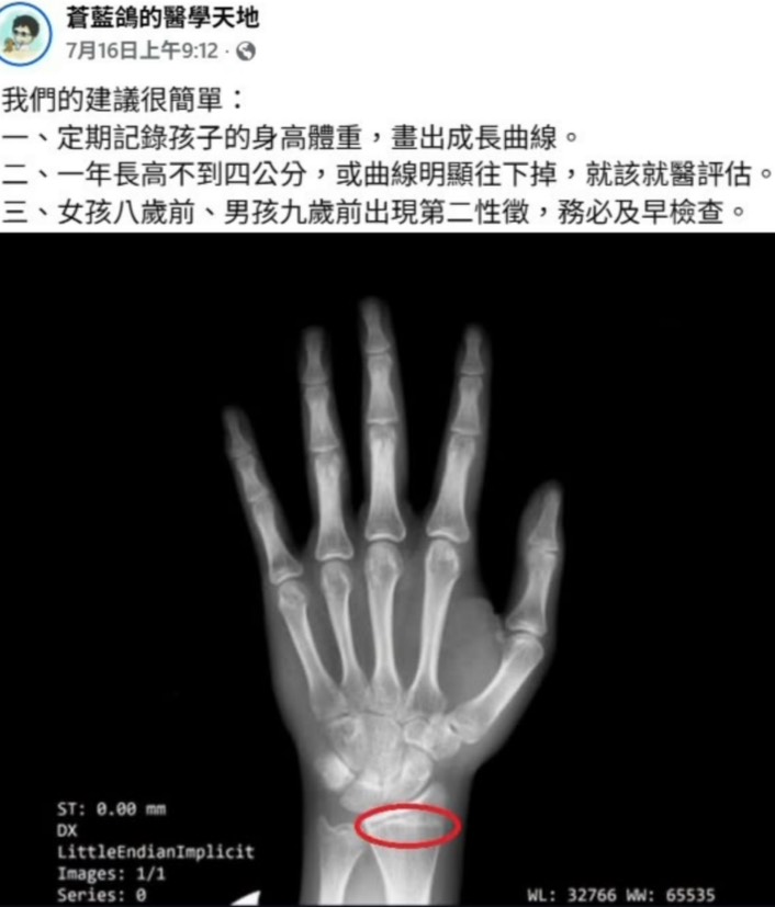 男生能長到成年？15歲男童身高卡關檢查驚見「這1危機」　醫列3大警訊：應及早就醫