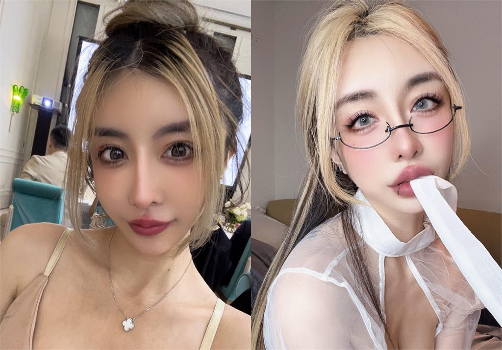 雪碧砸近千萬整形「眼睛留下後遺症」!她崩潰喊「像被針插」慘況曝光