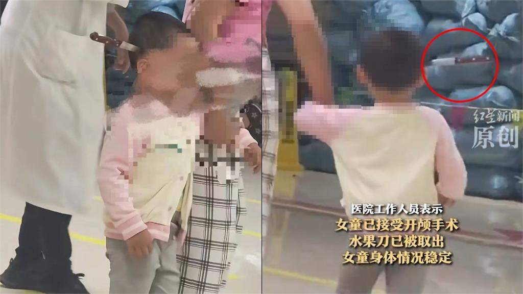 中國女童「頭插水果刀」進醫院不哭不鬧 網見畫面批:家長讓她自己走?