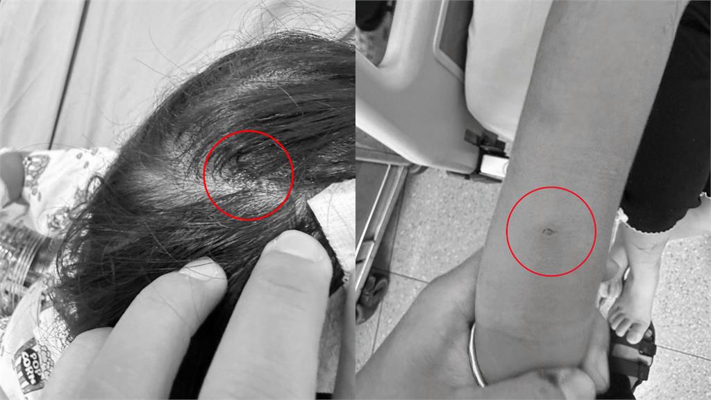 三義商店街黑狗「突暴衝咬3女童」！驚險畫面曝光…店家喊冤：狗不是我養的