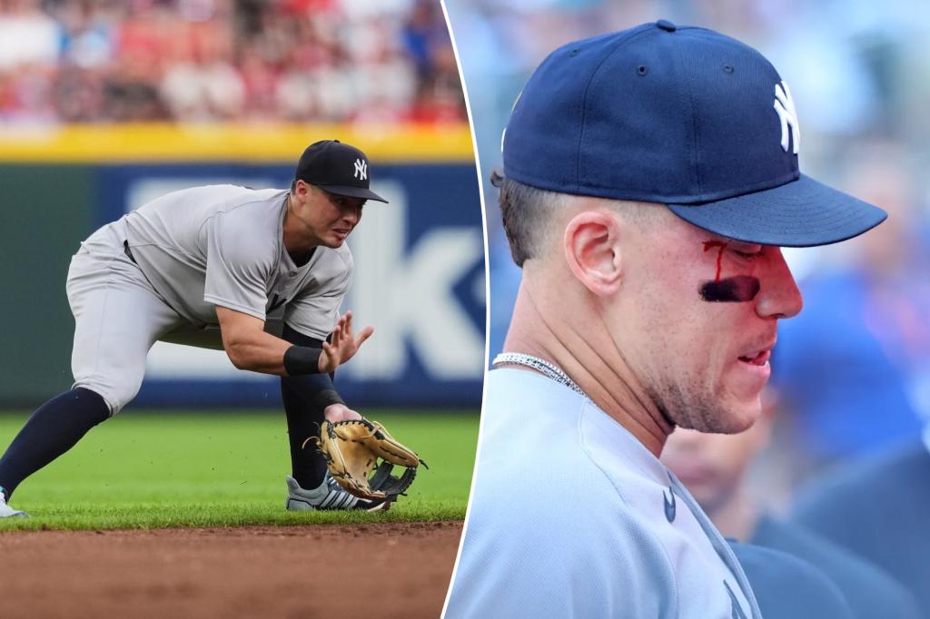 MLB(影)/「法官」意外遭球擊中臉、「羅東」首局挨滿貫重拳 洋基苦吞6連敗