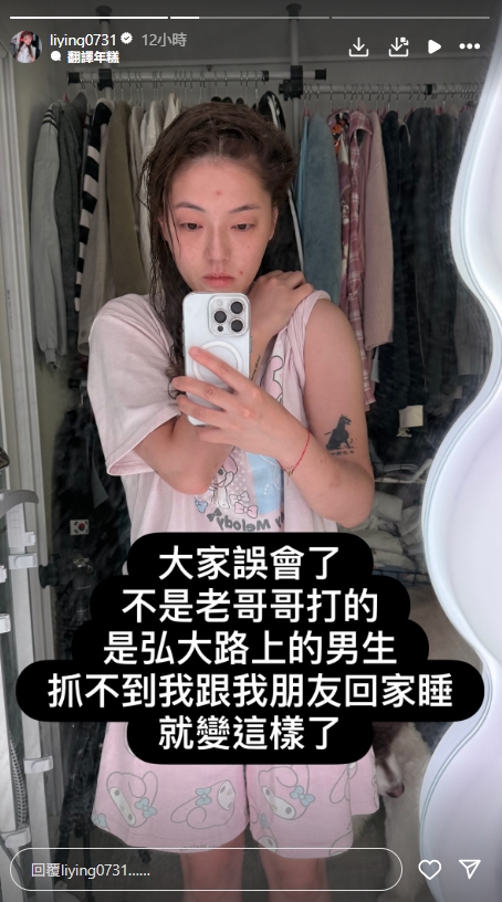台灣46萬YTR「拒絕陪睡」遭韓國人當街暴打！全身瘀青、骨折傷勢照曝光